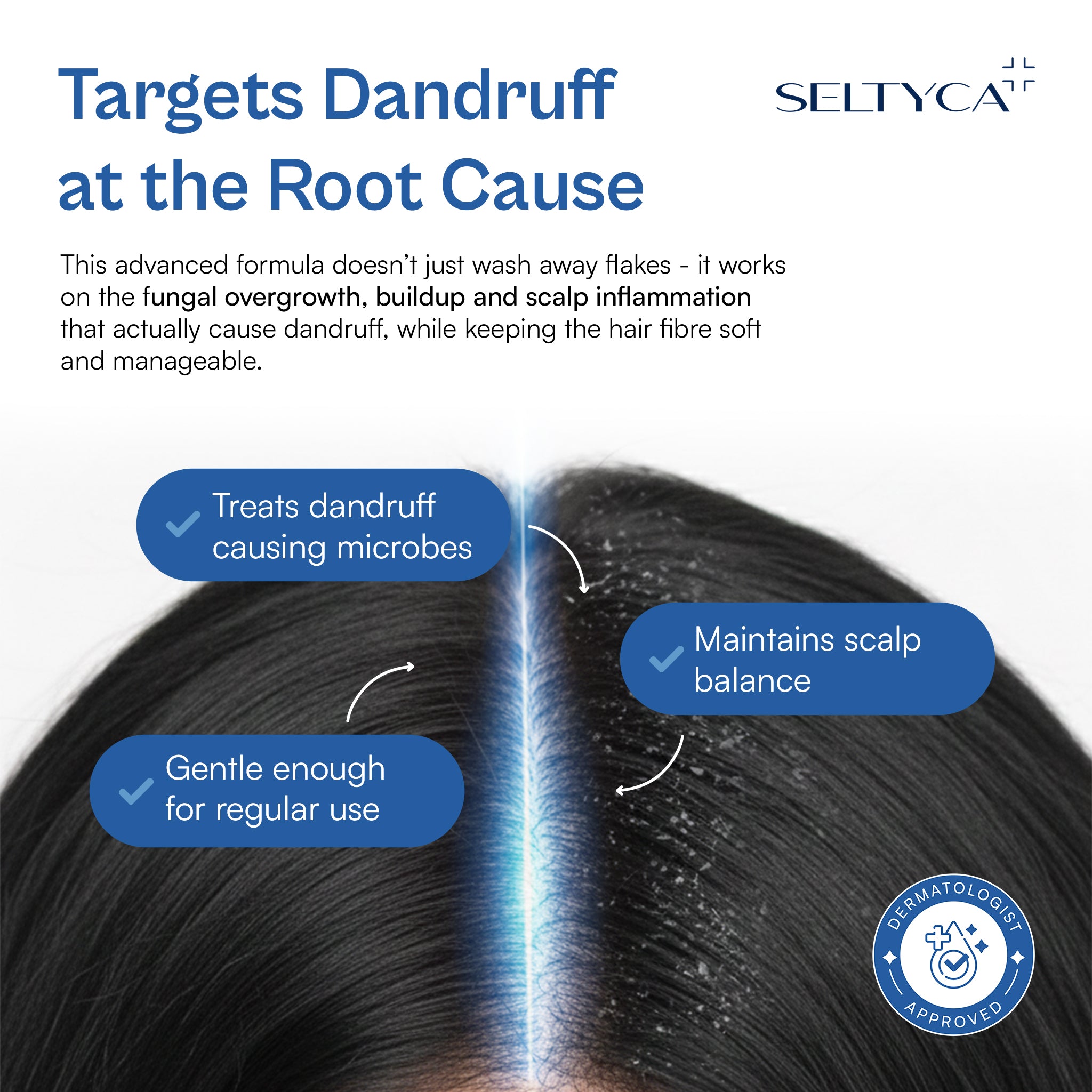 Seltyca anti dandruff shampoo visual showing treatment of dandruff-causing microbes, flaky scalp reduction and scalp balance for itchy, flaky scalp relief.