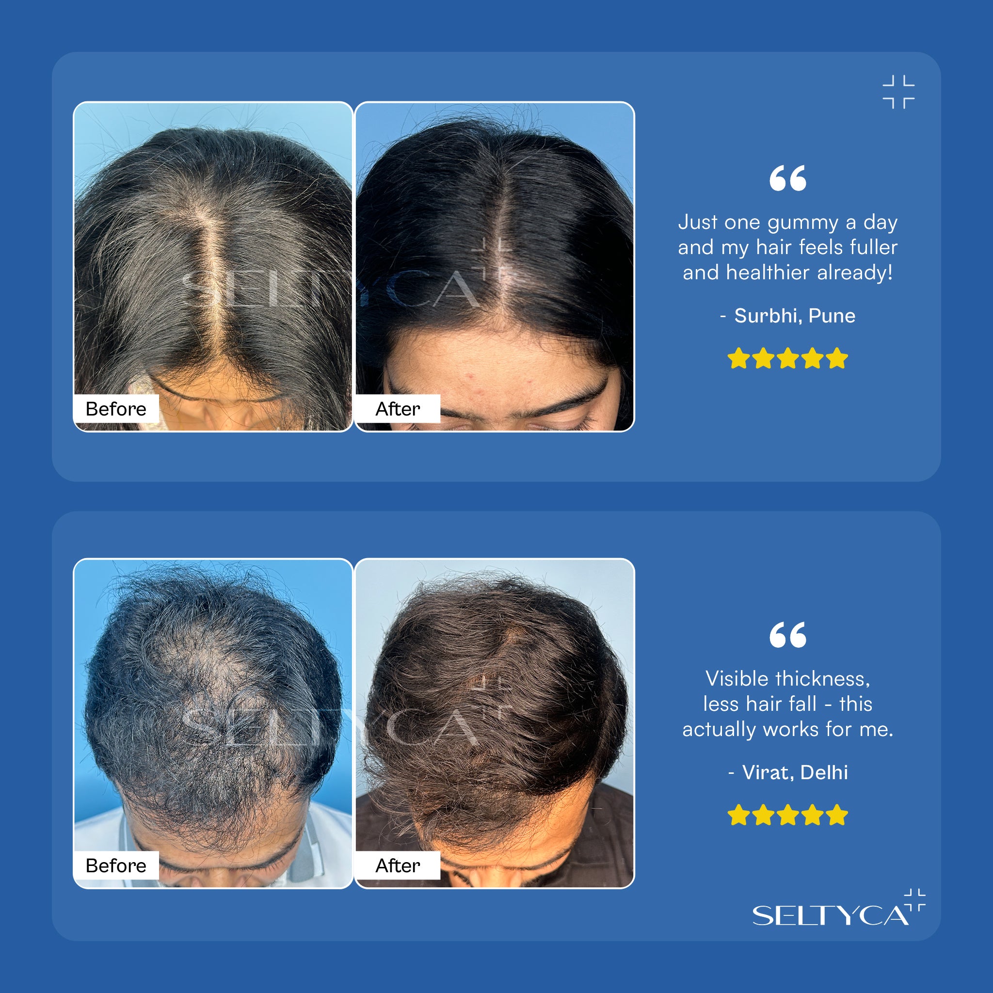 Seltyca Hair Growth Trio