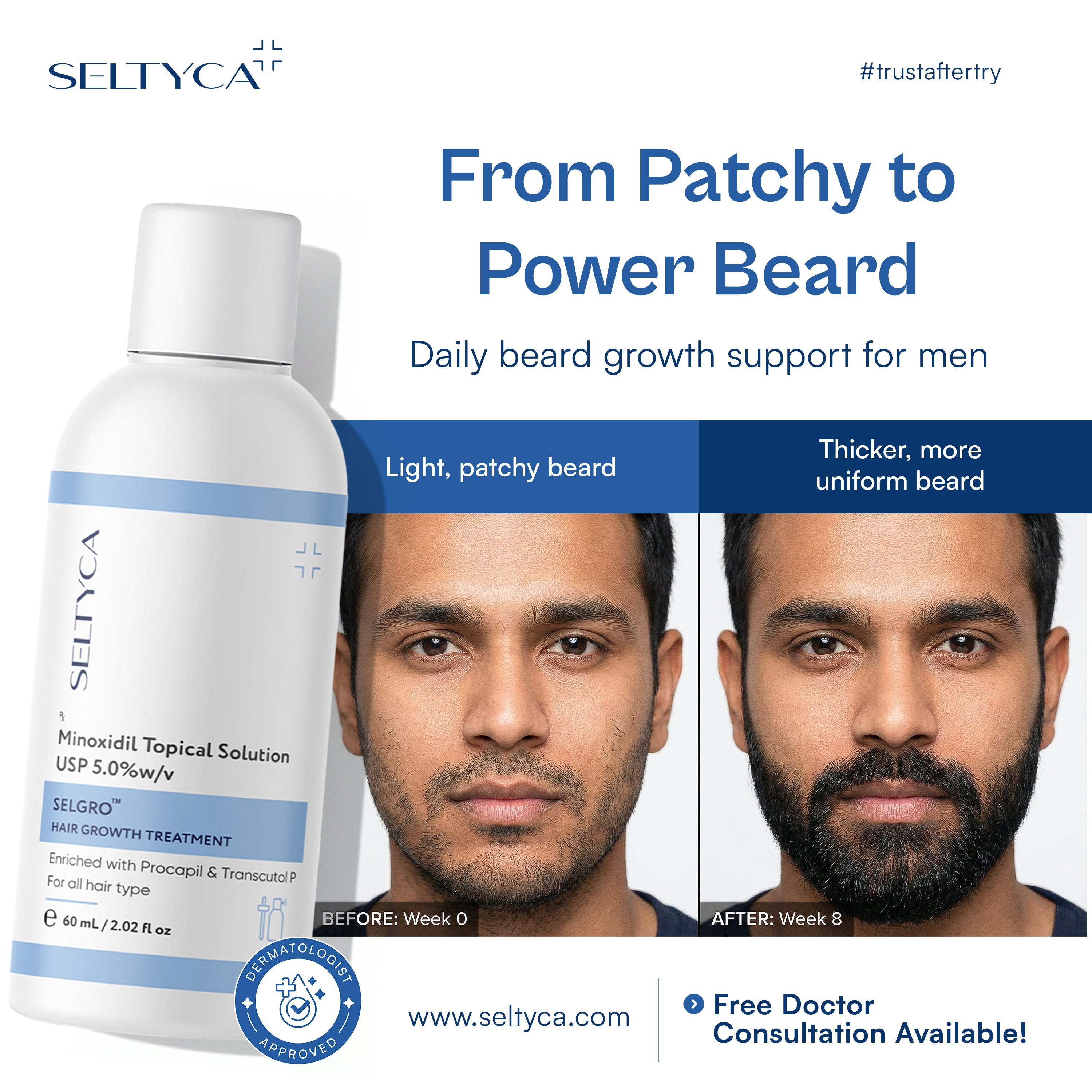 Selgro 5% Minoxidil For Beard Growth