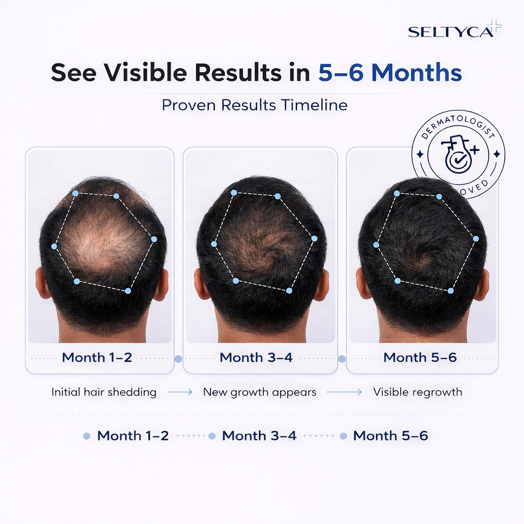 Stage 3 Hair Fall Kit (With Dandruff)