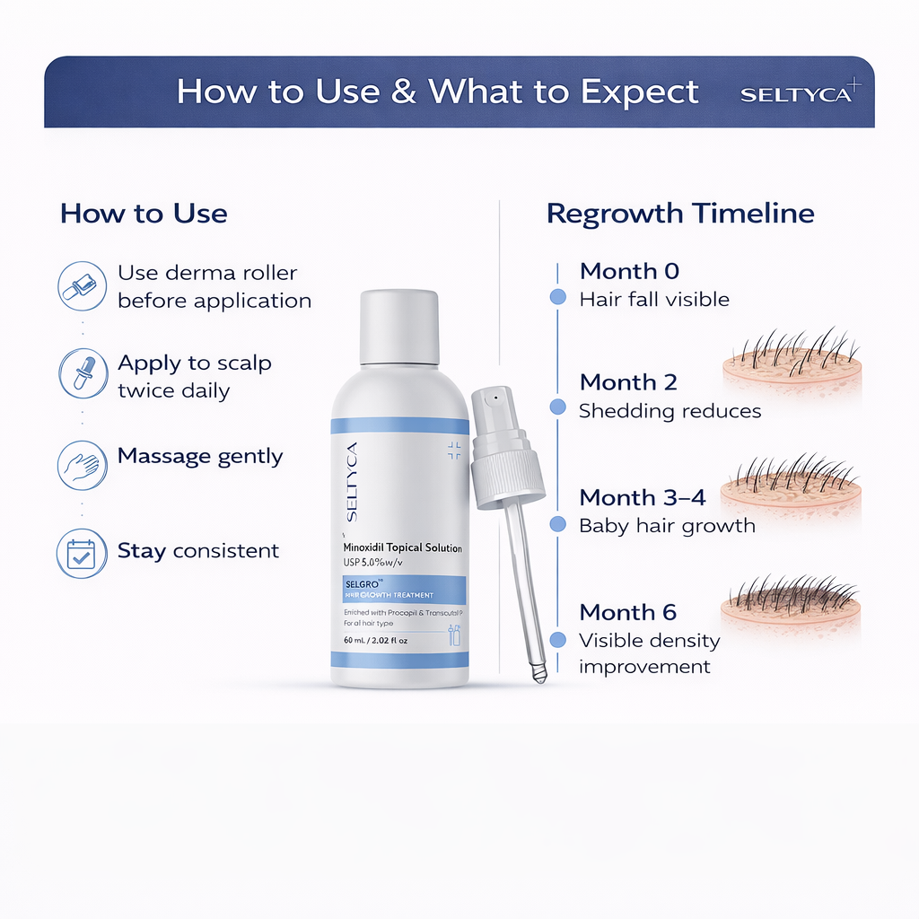 Stage 3 Hair Fall Kit (With Dandruff)