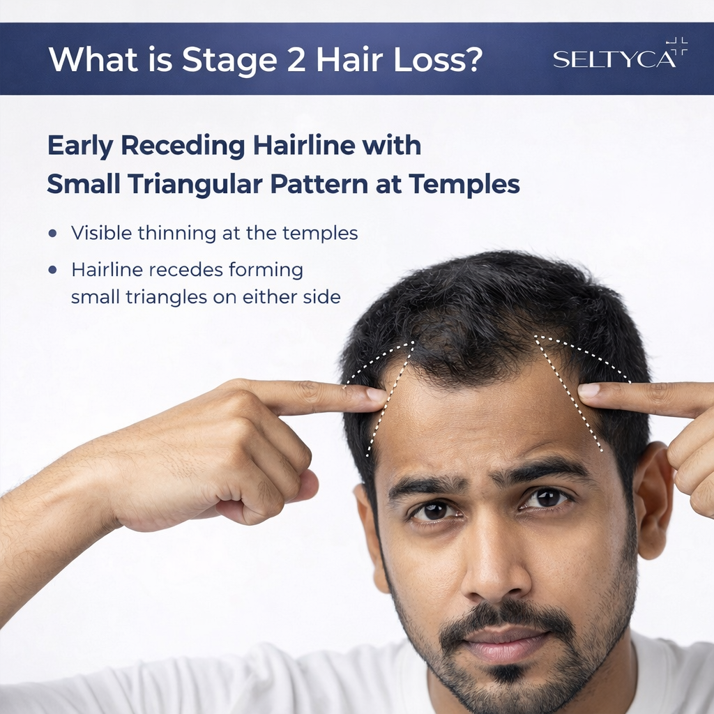 Stage 2 Hair Fall Kit (With Dandruff)