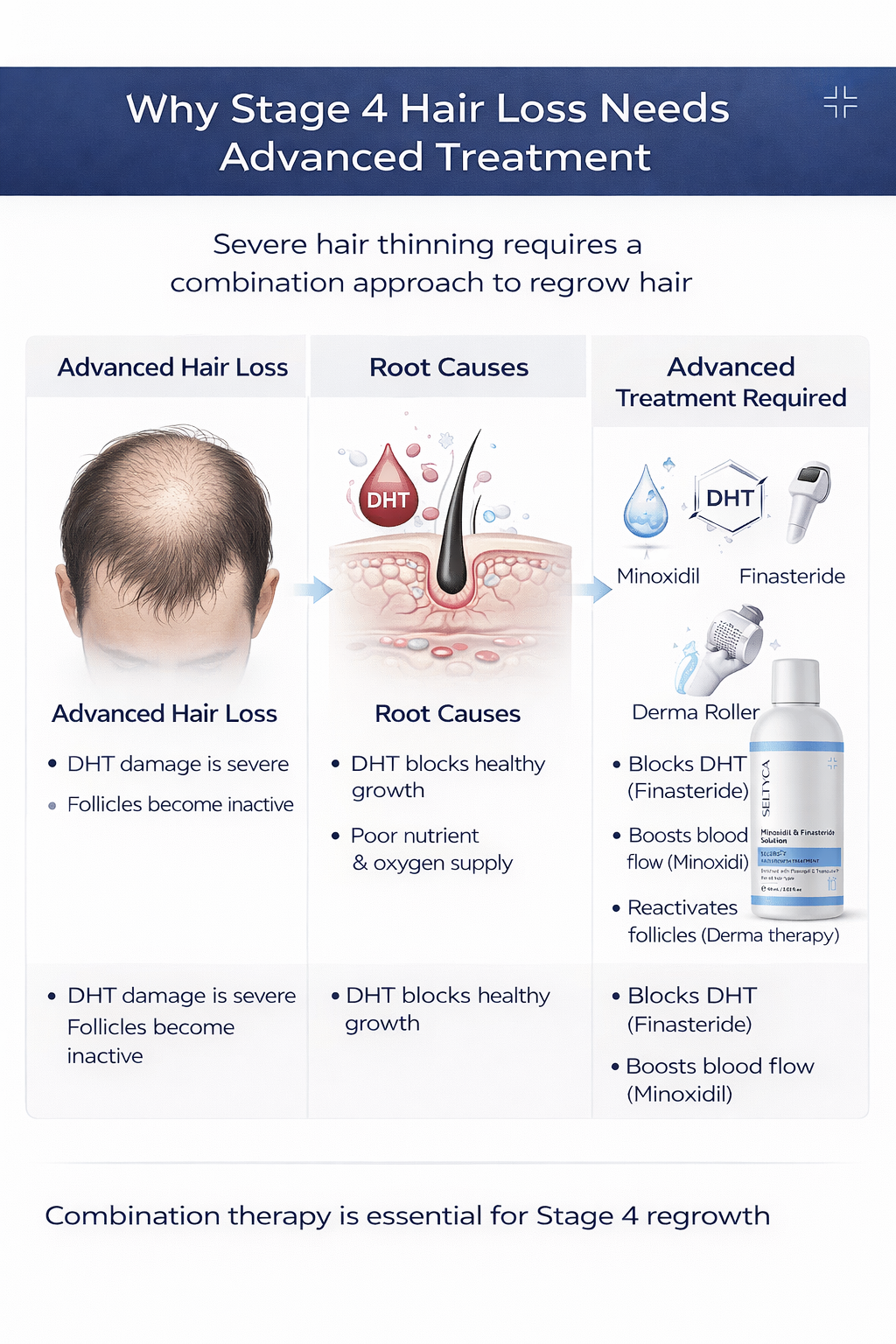 Stage 4 Hair Fall Kit (With Dandruff)