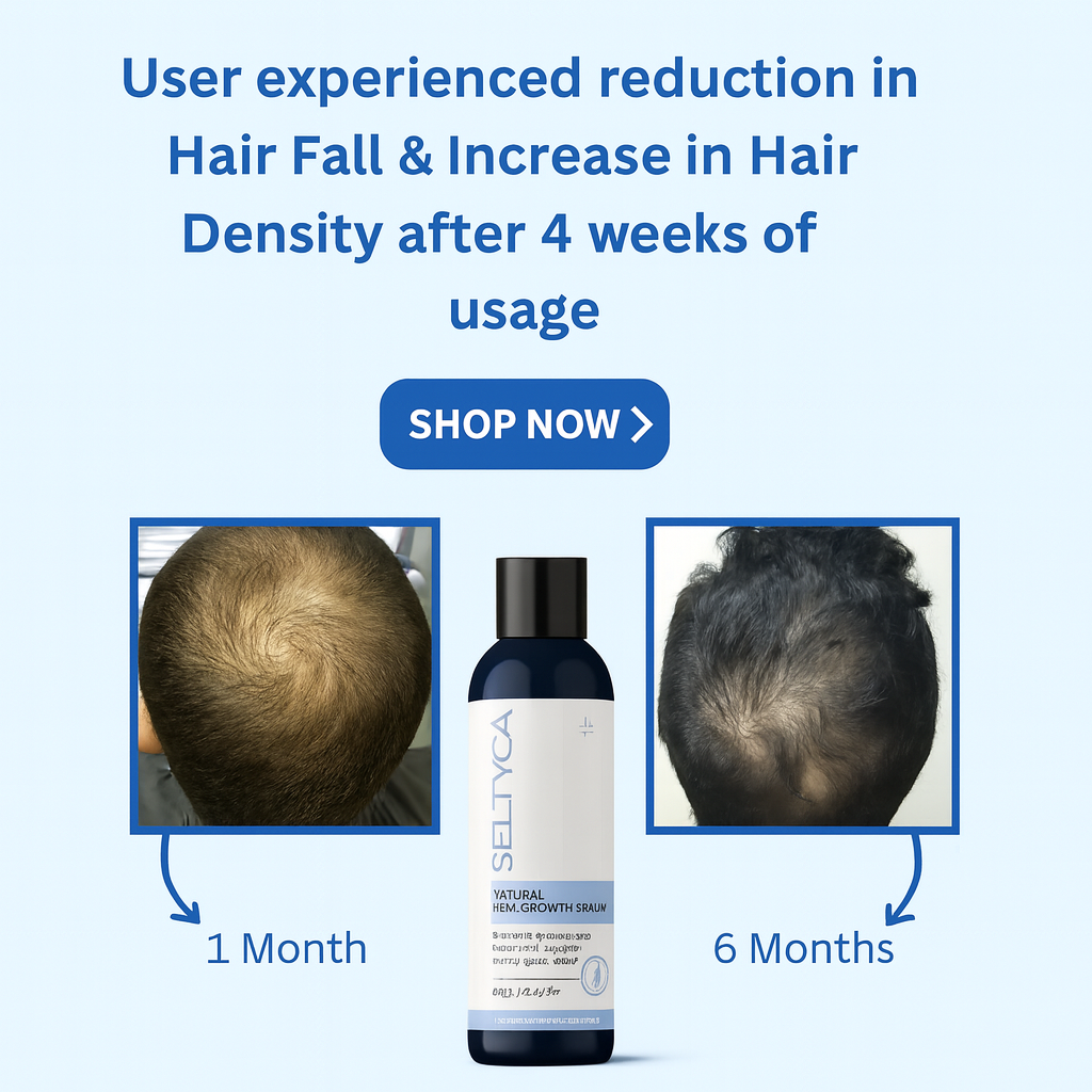 Seltyca Stage 2 Hair Fall Kit (No Dandruff)