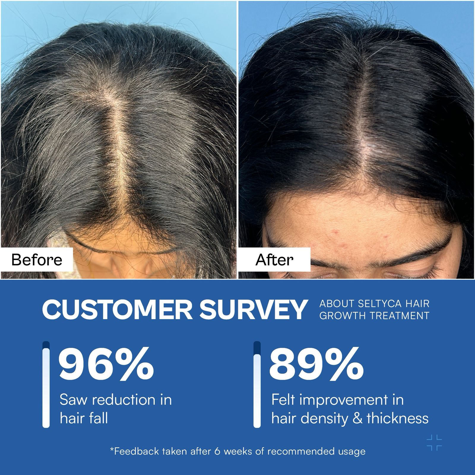 Seltyca Biotin Hair Growth Gummies