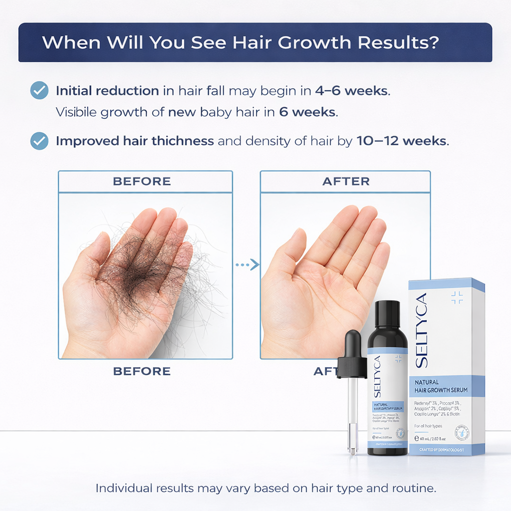 Hair Fall Kit Stage 2 Hair Fall Kit (No Dandruff) – Seltyca